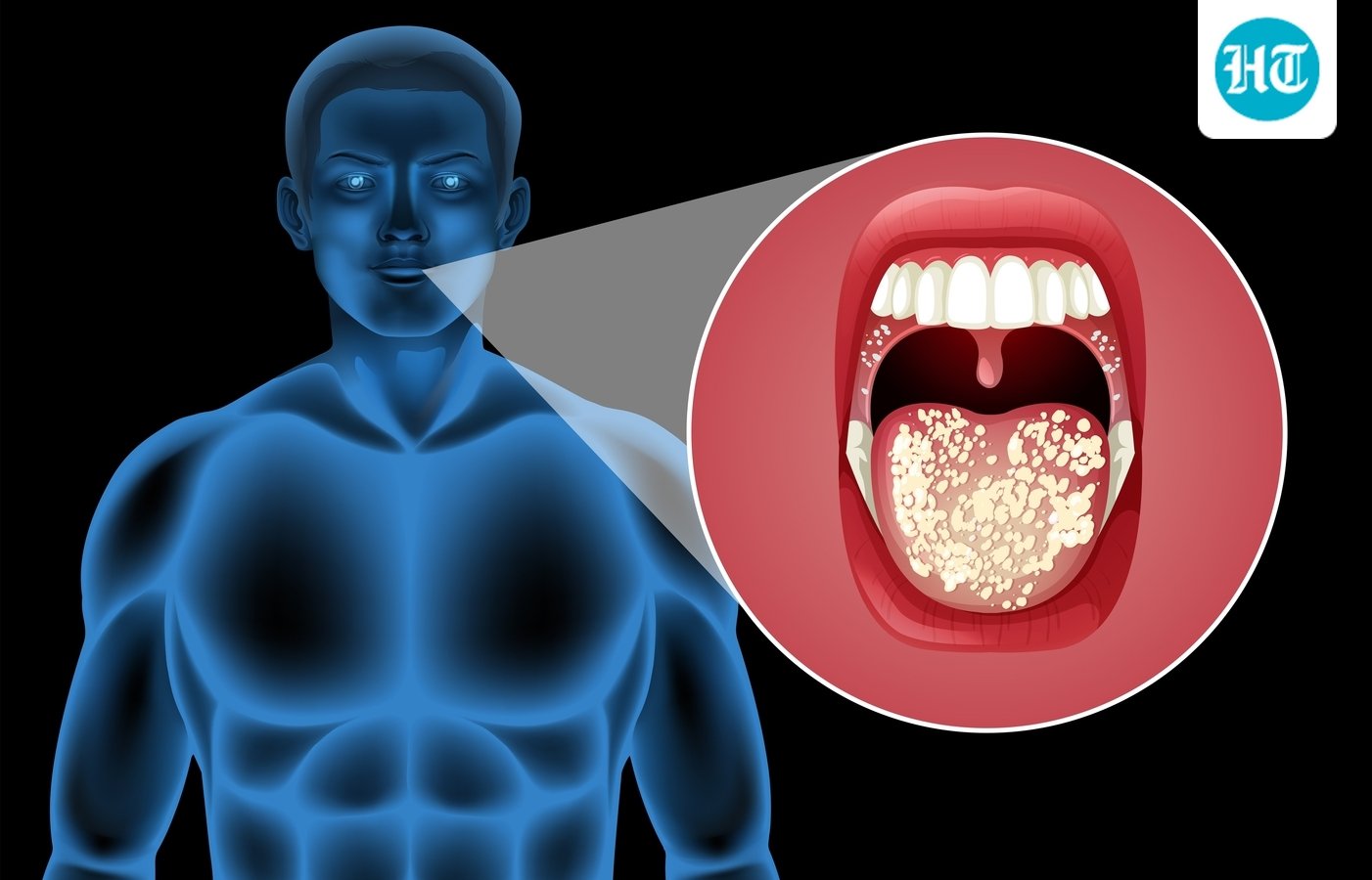 Onkolog menjelaskan bagaimana bahkan '1 gelas sehari' dapat secara perlahan meningkatkan risiko kanker mulut; membagikan tanda-tanda peringatan dini.