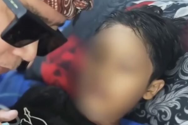 Seorang bocah laki-laki berusia 12 tahun dipaksa meminum air mendidih; ia menyebut nama pelaku yang diduga sebelum meninggal akibat luka bakar
